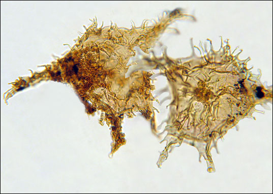 Fossils of the dinoflagellate cyst. Microscope image, spiky reddish-brown blobs.