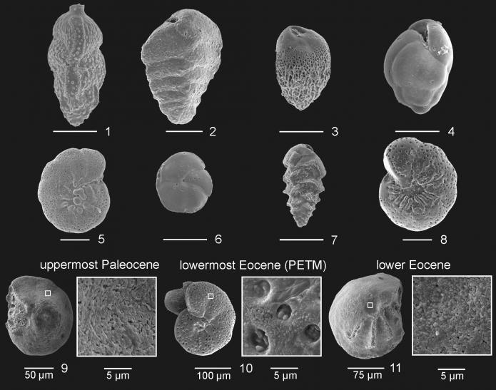 Benthic foraminifera fossils. Pore size changes and so does the size of the creature. distinctness of shape is also different