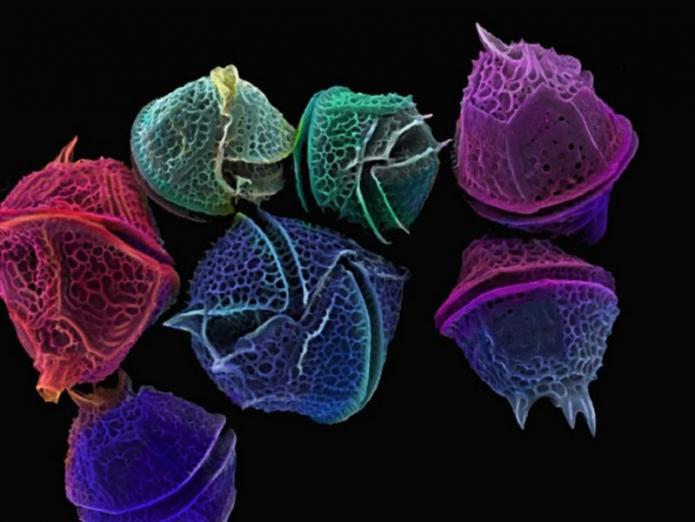 Electron Microscope Image of Dinoflagellate cysts