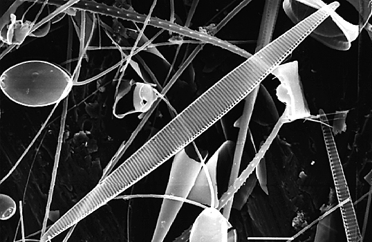 Scanning electron microscope image of Pseudo-nitzschia australis