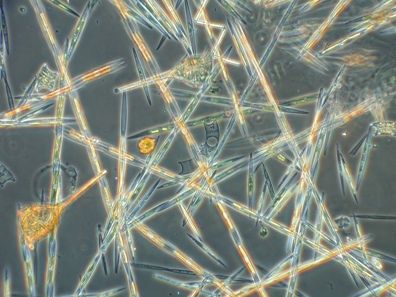 Pseudo-nitzschia, a toxin-producing diatom.