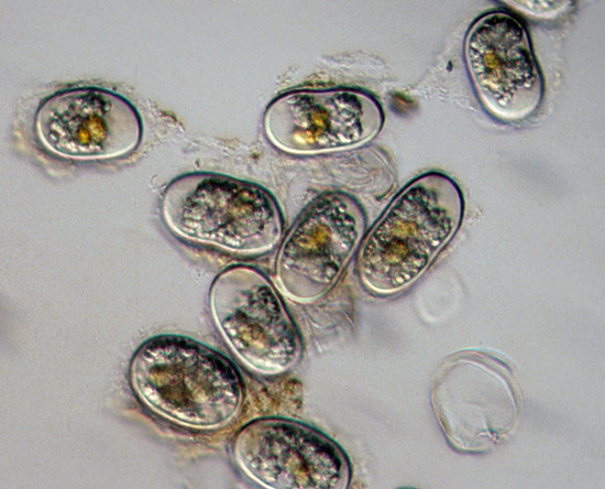 Scanning electron microscope view of cysts of the toxic alga Alexandrium tamarense