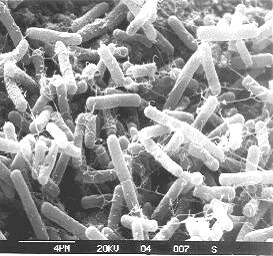 Micrografía de Clostridium acetobutylicum 824, bacteria ovular