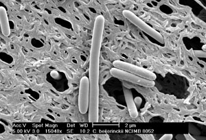 Micrografía de Clostridium beijerinckii BA101, bacteria ovular