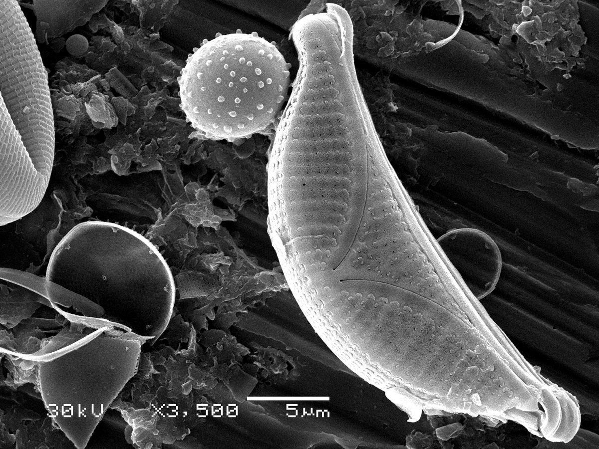 Electron microscope picture of diatom and grain of pollen. The diatom is only about 50 micrometers long!